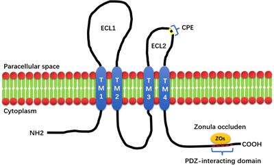 Research progress of Claudin-low breast cancer